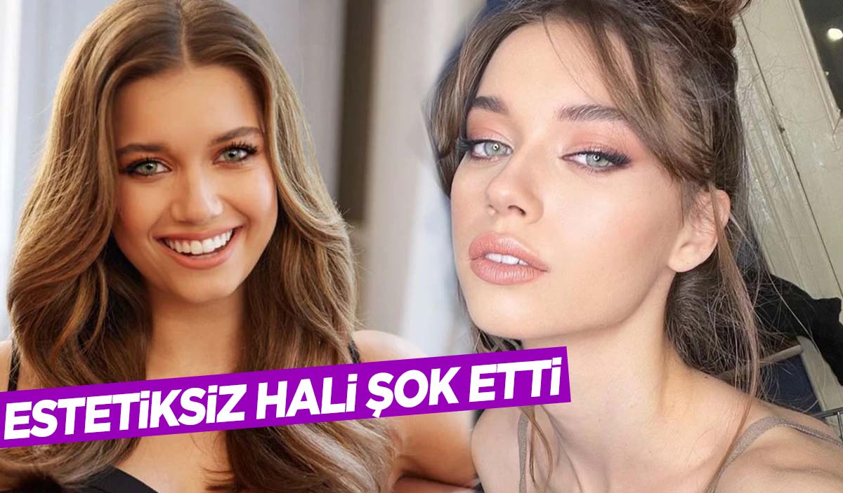 Yalı Çapkını’nın Seyran’ı Afra Saraçoğlu’nun estetiksiz hali ortaya çıktı!
