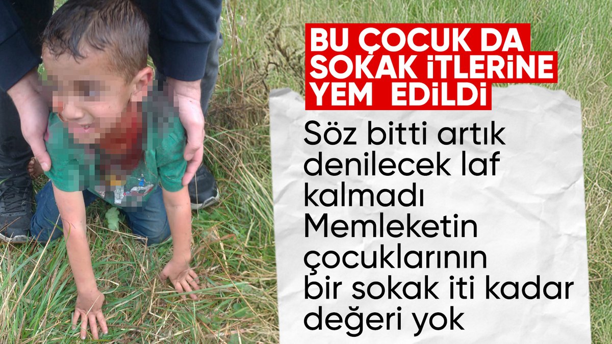 5 yaşındaki çocuğun durumu ağır