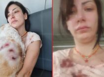 Genç kadın kanlar içinde kaldı! 'Bacağımın arkasını parçaladılar'