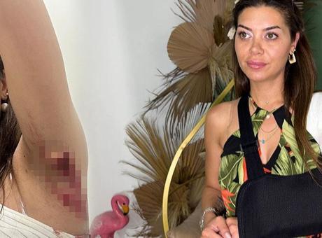 Sokakta yürürken jilet gibi kesikle yaralandı! ‘Kolumu kaybedebilirdim’