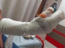 Kocaeli’de skandal iddia: Tedavi sonrası parmağı ampute edildi, kolunda metal bulundu
