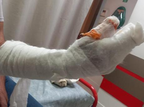 Kocaeli’de skandal iddia: Tedavi sonrası parmağı ampute edildi, kolunda metal bulundu