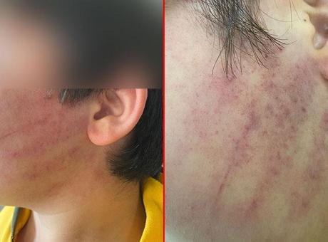 Sınıfta dehşet! Okulda gelen 3 kişilik aile 2 çocuğu hastanelik etti: Panoya kafasını birkaç kere vurmuş