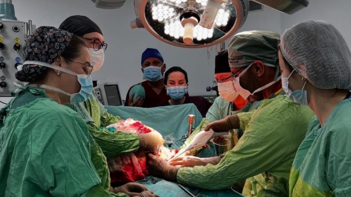 Trabzon'da karnından 26 kilogramlık tümör çıktı