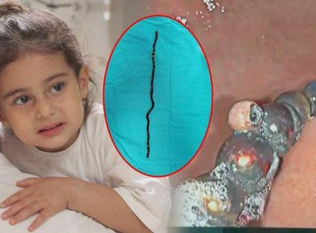 7 ay karnında taşıdı! 3 yaşındaki Berfin doktorları şoke etti! 'Bu oyuncak değil, ölüm tuzağıymış'