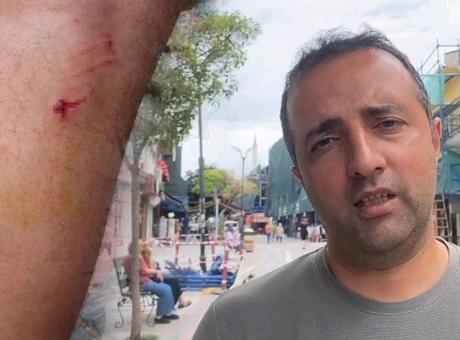 Edirne'de dehşet! 8 köpeğin saldırısına uğradı