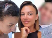 Uzaklaştırma kararı sonrası vahşet! Kafatasına zımba atıldı, elleri kırıldı: Plan yapıp beni öldürmeye geldi