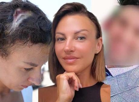 Uzaklaştırma kararı sonrası vahşet! Kafatasına zımba atıldı, elleri kırıldı: Plan yapıp beni öldürmeye geldi