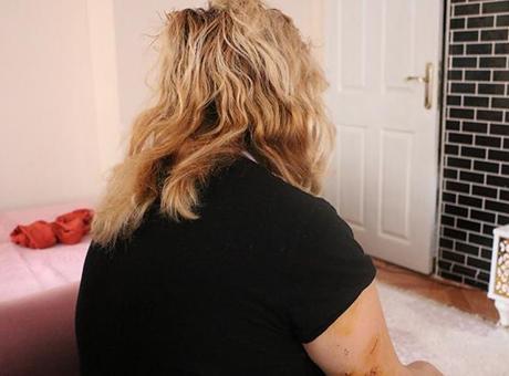 30 yerinden bıçakladı: Yarım kalan işini tamamlayacağından korkuyorum