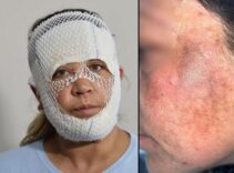 7 bin liralık ‘Prenses cilt bakımı’ kabusu: Oğlum beni görünce 'öcü' diyerek kaçtı