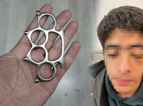 Esenyurt’ta akran dehşeti! Gözünü kaybetme riskiyle ameliyata alınan çocuğun yüz kemikleri kırıldı