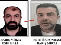 HABERLER: Ameliyat ile yüzünü değiştirmiş! 7 yıl sonra yakalandı...