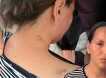 Ölü numarası yaparak kurtuldu: Geceleri uyuyamıyorum