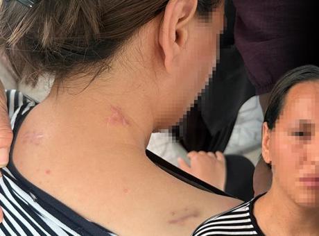 Ölü numarası yaparak kurtuldu: Geceleri uyuyamıyorum