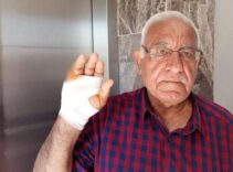 Asansörde korkunç saldırı! Komşusu parmağını ısırarak kopardı: Onu çok severdim, niçin yaptı anlamadım