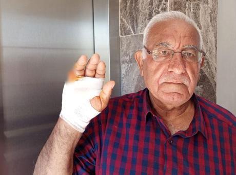 Asansörde korkunç saldırı! Komşusu parmağını ısırarak kopardı: Onu çok severdim, niçin yaptı anlamadım