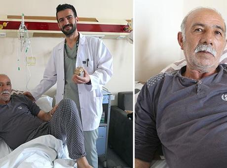Mesanesinden çıkan taş doktorları şoke etti! 'Bayılmak istedim, böyle bir şey olamaz'